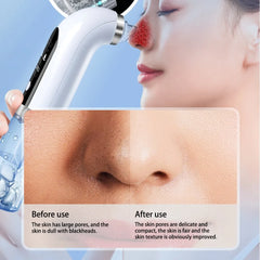 USB Rechargeable Blackhead Remover Device